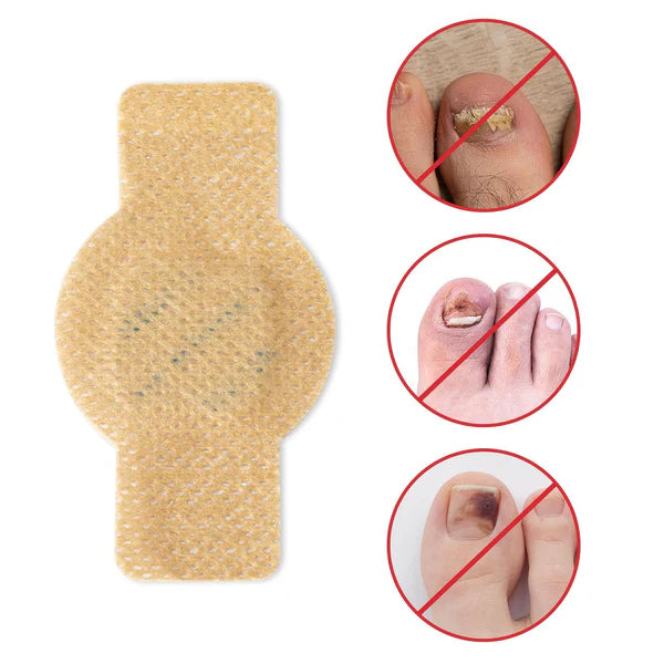 NailHeal™ - Fungal Nail Patches 🌿💅 ( Buy 1 Get 1 Free🔥🔥)